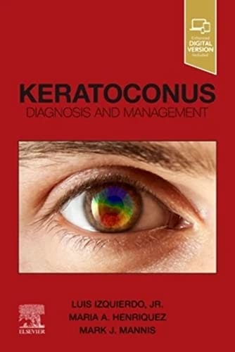 Keratoconus Diagnosis and Management: $111.08 Keratoconus Diagnosis and Management: $111.08