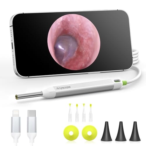 Digital Otoscope Ear Camera: $23.99 Digital Otoscope Ear Camera: $23.99