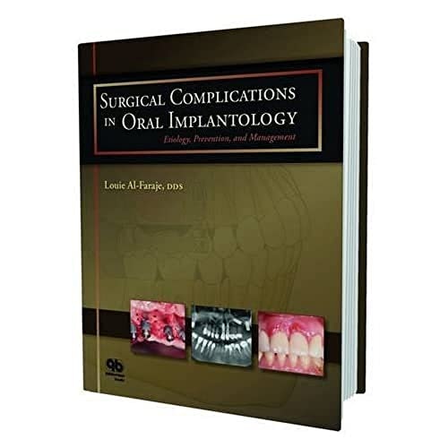 Surgical Complications in Oral Implantology: Etiology, Prevention, and Management: $28.68 Surgical Complications in Oral Implantology: Etiology, Prevention, and Management: $28.68