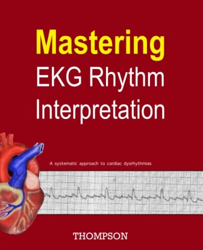 Mastering EKG Rhythm Interpretation: $35.01 Mastering EKG Rhythm Interpretation: $35.01