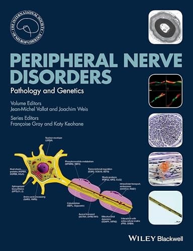 Peripheral Nerve Disorders: Pathology and Genetics: $148.39 Peripheral Nerve Disorders: Pathology and Genetics: $148.39