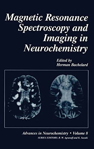 Magnetic Resonance Spectroscopy and Imaging in Neurochemistry: $52.05 Magnetic Resonance Spectroscopy and Imaging in Neurochemistry: $52.05