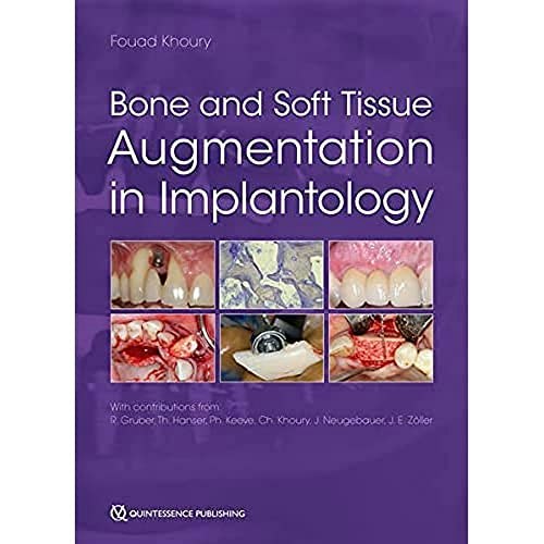 Bone and Soft Tissue Augmentation in Implantology: $266.52