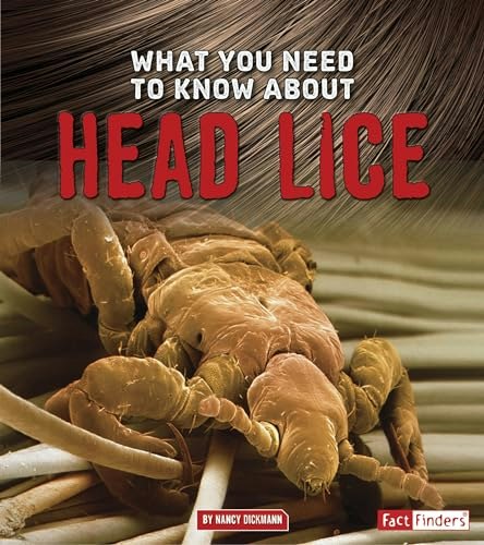 What You Need to Know about Head Lice: $7.68 What You Need to Know about Head Lice: $7.68