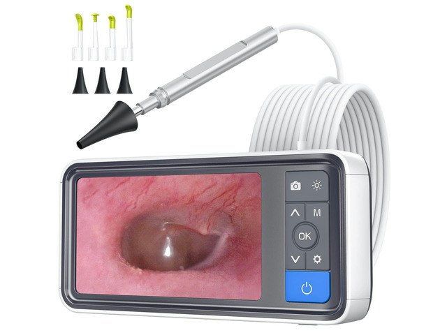 Otoscope with 4.5" IPS Screen and 32GB SD Card: $64.33