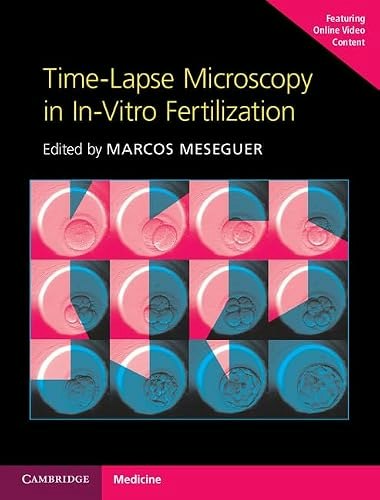 Time-Lapse Microscopy in In-Vitro Fertilization Hardback: $39.78 Time-Lapse Microscopy in In-Vitro Fertilization Hardback: $39.78