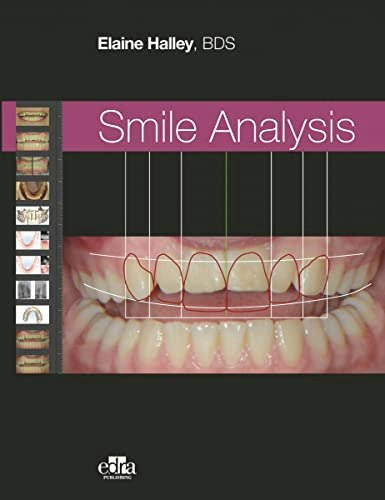 Smile Analysis: $183.04